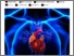 [thumbnail of Substance 2017 17182 Automating Cardiac Disease Detection.pdf]