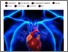 [thumbnail of Substance 2017 17183 Automatiser le depistage des maladies cardiaques.pdf]