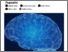 [thumbnail of Substance 2017 17169 Fiberprint Human Brain Wiring Shows Unique Fingerprint.pdf]