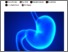 [thumbnail of Substance 2017 17167 Printing a 3D Stomach Teaching Tool.pdf]