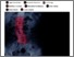 [thumbnail of Substance 2018 18316 Dynamic Classification of Abnormal.pdf]